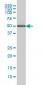 HERPUD1 Antibody (monoclonal) (M04)